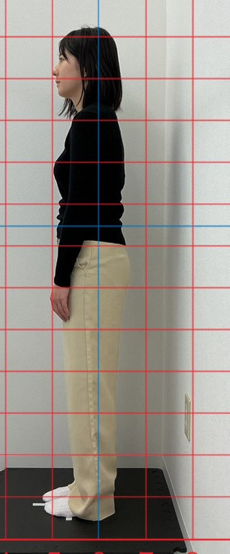 20代女性の施術前の立ち姿勢