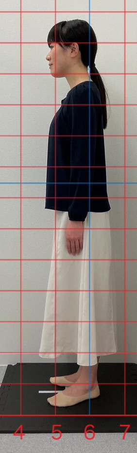 30代女性の施術前の立ち姿勢